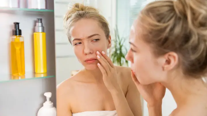 can niacinamide cause acne