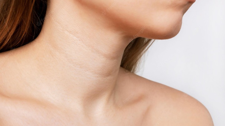 neck lines